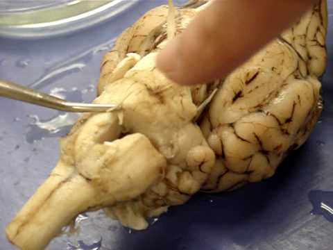 Sheep Brain Cranial Nerves - YouTube