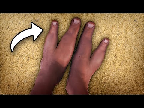 I Met Zimbabwe's Tribe with Only 2 Toes