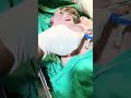 First Cut of Life ✂️ Umbilical Cord Cutting After Delivery | Real Moment”