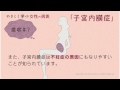 女性の病気　子宮内膜症