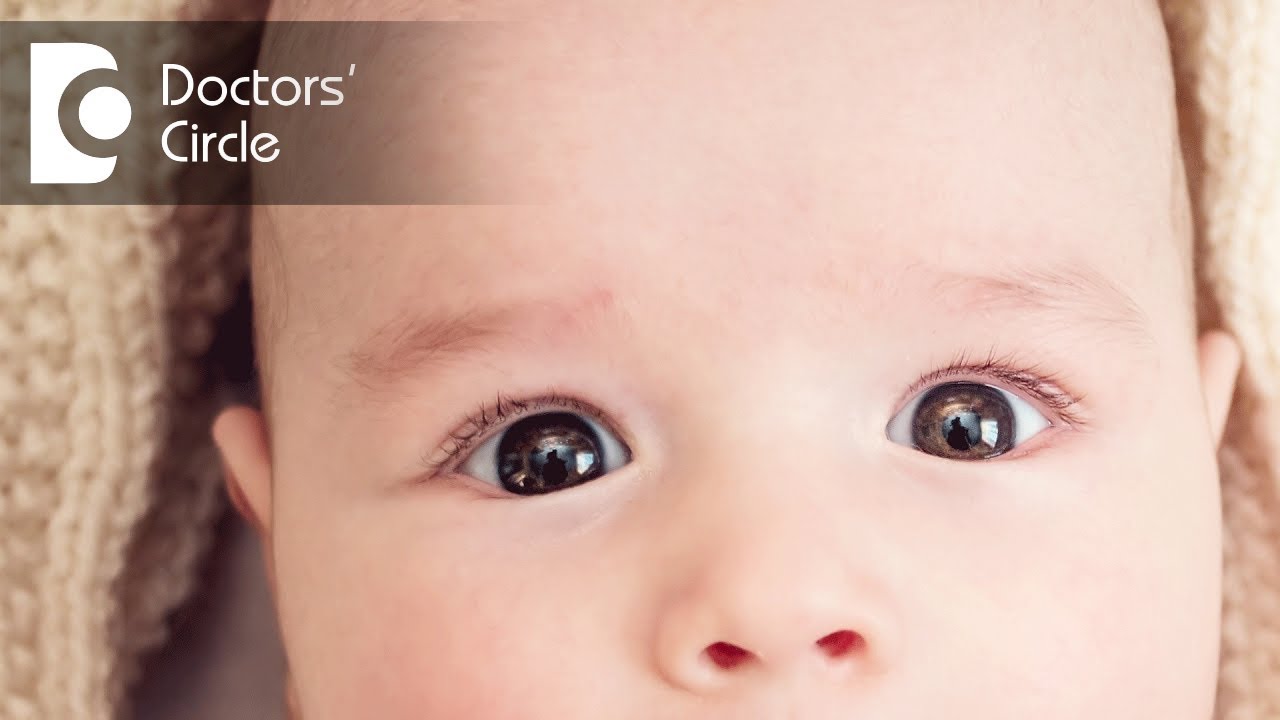 How To Get Rid Of Red Spot Developed In The Sclera Of An Infant Dr