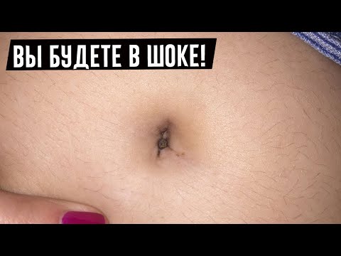 Самая Грязная часть тела у Человека, и как ее Очистить!