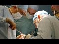 Surgeon reveals what happens once the anesthesia kicks in