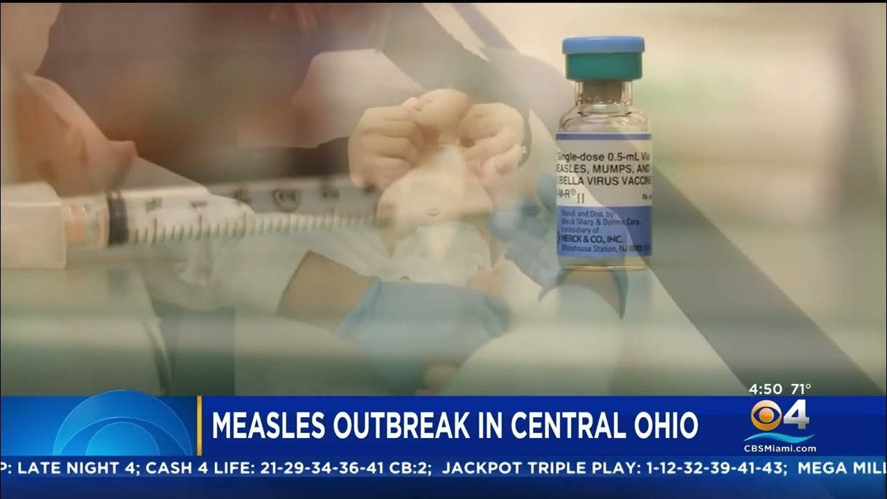 Measles Outbreak in Ohio YouTube