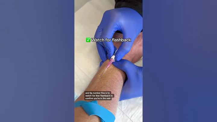 IV Start Tips💉 #RN #BSN #nursehumor