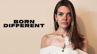 I Haven’t Eaten In 4 Years | BORN DIFFERENT
