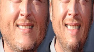 5 Best Face Exercises To Get Perfect Strong Defined Jawline For Men - Exercises to Get TIGHTEN CHIN!