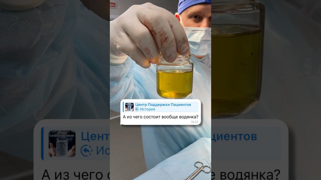 Из чего состоит водянка? 