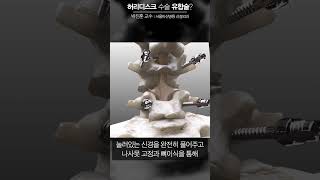 허리 디스크 수술 유합술? #서울아산병원#허리디스크