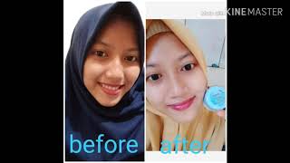 TESTI LAVINA SKINCARE PAKET ACNE GLOWING