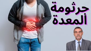 جرثومة المعدة، كيفية العلاج الطبيعي في المنزل #الدكتور_محمد_الفايد