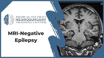 MRI-Negative Epilepsy