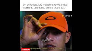 MC Mãozinha revela o que realmente aconteceu com o braço dele