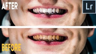 How to Whiten Teeth in 60 Seconds in Adobe Lightroom? (QUICK & EASY) screenshot 5