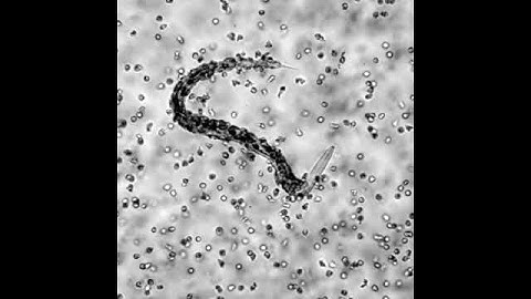 Human Eosinophils Coat a Worm