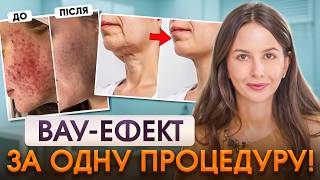 Результат буде вже з першого разу! ТОП-5 процедур проти зморшок і проблемної шкіри