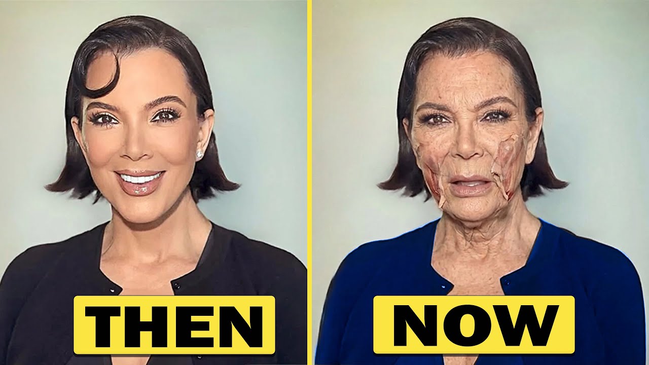 1515 Plastic Surgery Transformations No One Expected to Look This Extreme | Then and Now 2025