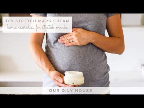 Homemade Stretch Mark Cream | Home Remedies for Stretch Marks