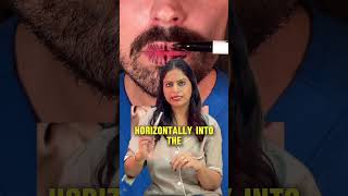 Russian Lips vs Normal Lip Filler 👄 Kaunsa Better Lagta Hai? | Lip Filler Truth Explained #explore