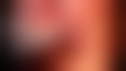 Intraoperative cholangiography SAGES