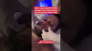 Download Lagu Vera Pelle European Skin Spa / Facial buccal lymphatic fascia massage #tmj #bellpalsy #massage #skin MP3