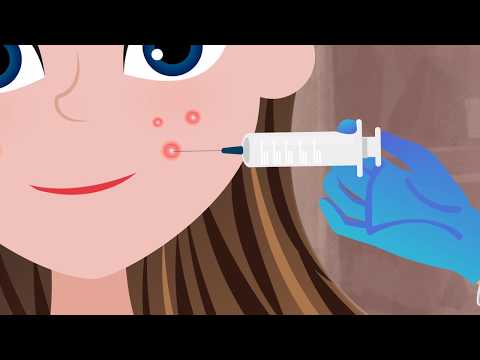 Cortisone Injection for a Big Pimple