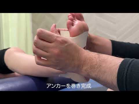 立方骨症候群のテーピング