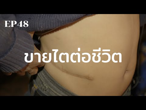 ขายไตต่อชีวิต | ร้อยเรื่องรอบโลก EP48