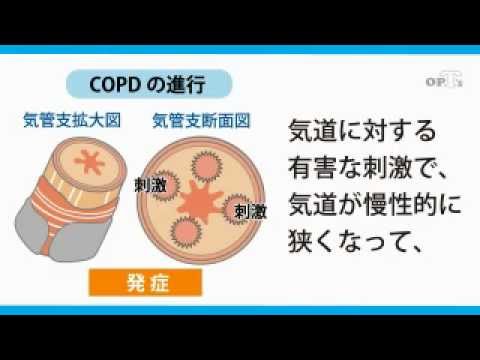201304_2_264健康講座_COPD