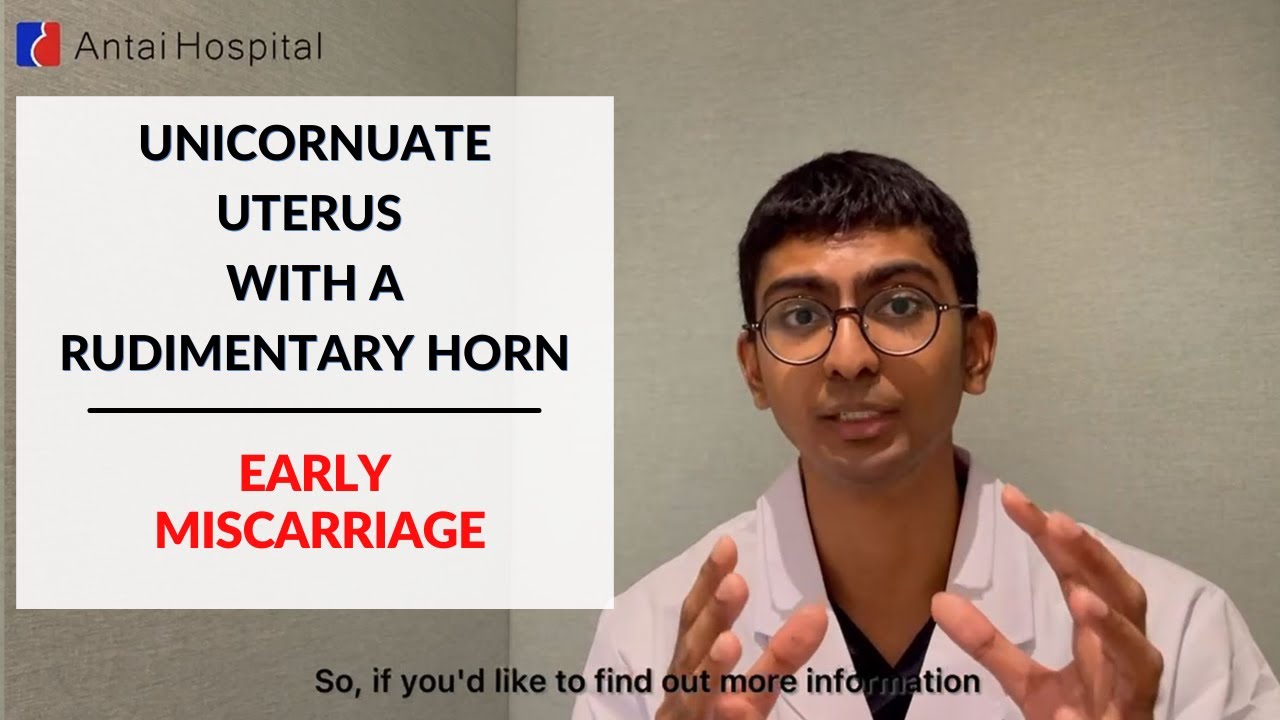 Unicornuate Uterus Rudimentary Horn Early Miscarriage Miscarriage Causes Antai Hospital