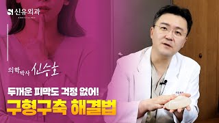 심한 구형구축, 두꺼운 피막도 쉽고 깔끔하게 제거!| 신유외과 SHINYU CLINIC