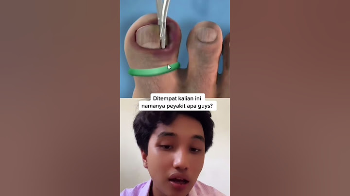 CEPAT SEMBUH YANG TERKENA CANTENGAN 😇😇😇#shorts #viral #humor #reaction