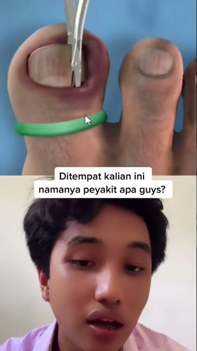 CEPAT SEMBUH YANG TERKENA CANTENGAN 😇😇😇#shorts #viral #humor #reaction