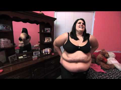 Extreme Makeover Weight Loss Edition - Meet Rachel