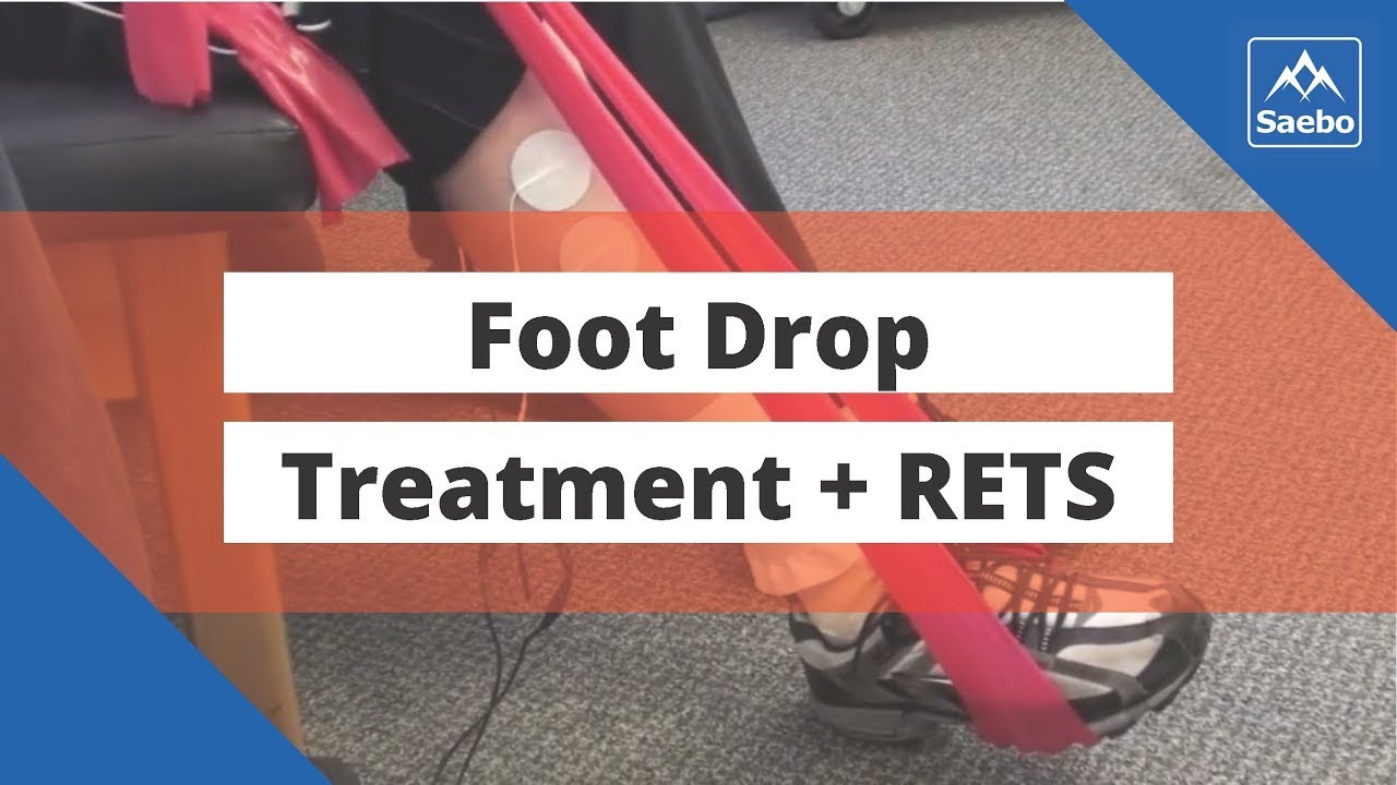 Foot Drop Treatment Using Reciprocal Emg Triggered Stimulation Youtube