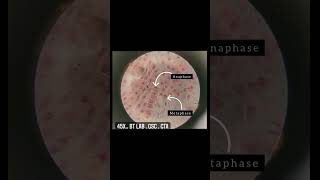 Mitosis stages in oinion root tip 45X acetocarmine stain Mitosis Coloring Exercise For Improved Retention