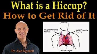 What is a Hiccup? How to Get Rid of It (Excellent Home Remedies) - Dr. Alan Mandell, D.C.
