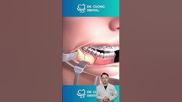 Đố bạn! Đây là phẫu thuật gì? |Dr Cường Official