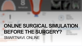 Quick tutorial for the new simulation on the DIOnavi. website