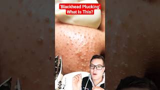 PLUCKING BLACKHEADS - New Blackhead Removal Technique #shorts