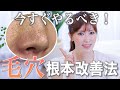 【毛穴改善】美容のプロがたるみ毛穴・開き毛穴の原因と根本改善法を徹底解説！これを見ればやるべきケアが全てわかります！