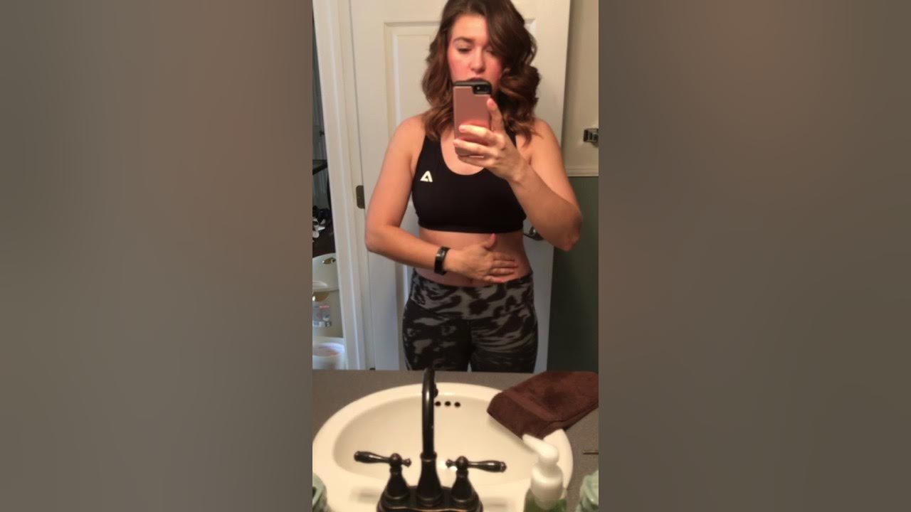 Week 4 Post Op Tummy Tuck with spitting stitch video 1 YouTube