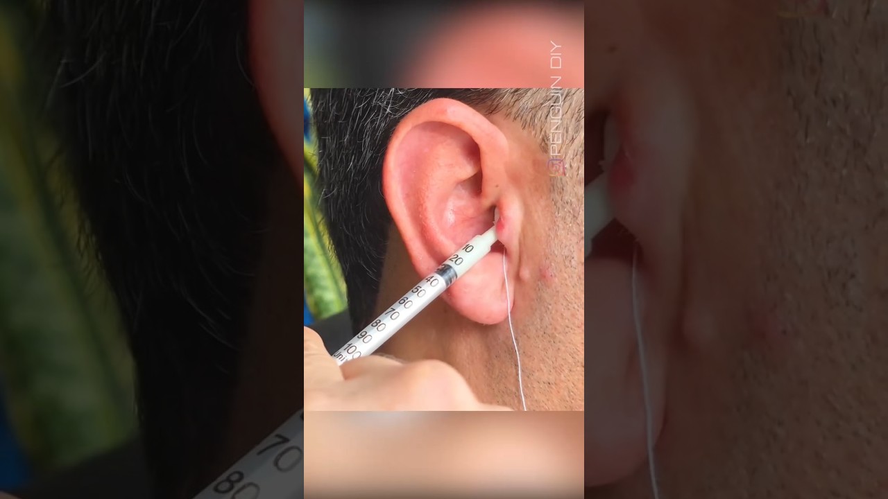 Invisible earphones, built completely from scratch. 🕵️♂️🎧