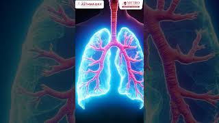 Asthma Breathlessness Explained | Causes &amp; Treatment Tips! #Asthma  #Doctor #Breath #Shorts