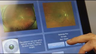 Virtual imaging system helps detect potential blindness among diabetic patients