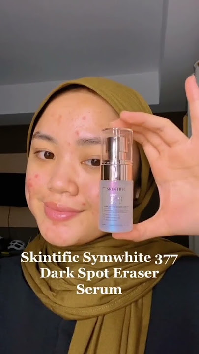 Cara Menghilangkan Bekas Jerawat Dan Flek Hitam Dengan Cepat