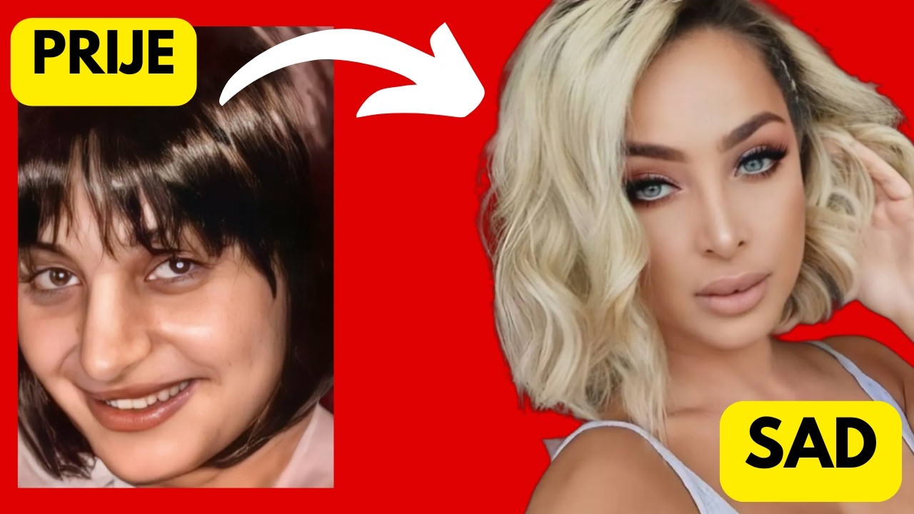 POGLEDAJTE KAKO SU IZGLEDALE PJEVAČICE PRIJE I NAKON PLASTIČNIH OPERACIJA! *šokantne promjene*