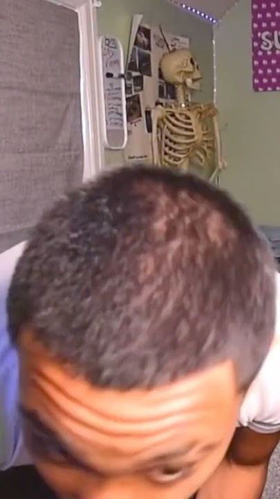 I Do NOT Have A Bald Spot…