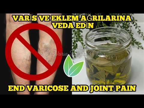 Say Goodbye to Varicose Veins and Joint Pains with Bay Leaf, which is Absolutely 100% Effective! 🍃