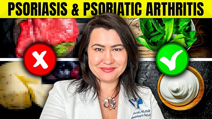 Warning: 8 WORST Foods for Psoriasis and Psoriatic Arthritis